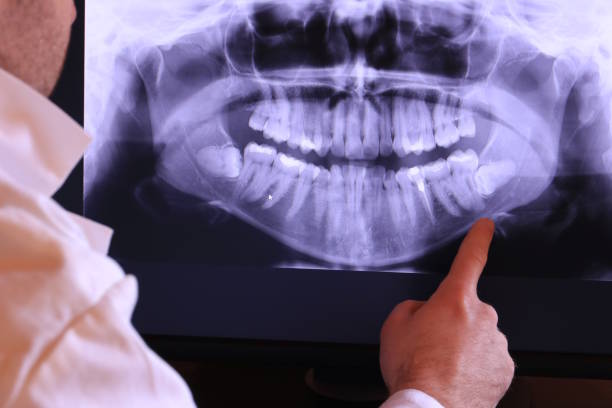 Best Emergency Dentist for Knocked-Out Tooth in Worcester, MA
