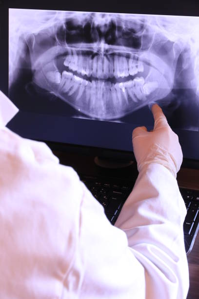 Best Emergency Dental Extractions in Worcester, MA